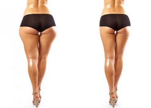 Бедра галифе, что носить. Как скрыть ушки на бедрах при помощи одежды