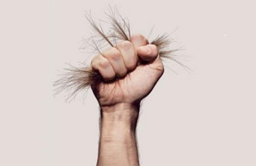 Облысение в 20 лет: причины и способы борьбы 01