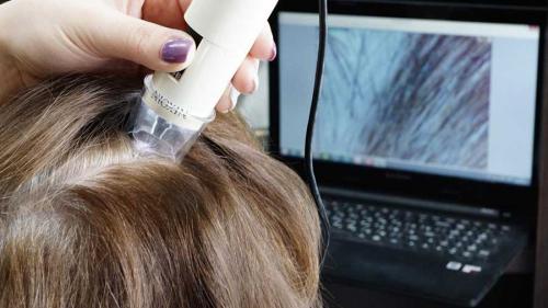 Почему одни мужчины лысеют, а другие нет? Основные причины облысения 01 Почему одни мужчины лысеют, а другие нет? Основные причины облысения 01