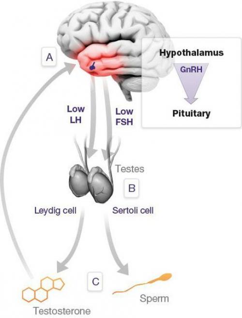 Почему выпадают волосы у мужчин в молодом возрасте: основные причины и решения 03