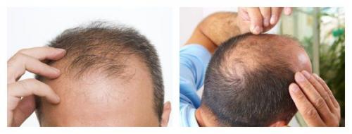 Торчащие волосы по длине волос. Волосы «с искрой» 03