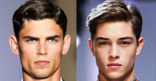 Торчат короткие волосы на макушке у мужчин. БОЛЬШИЕ УШИ