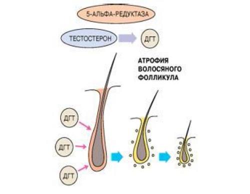 Линия роста волос у женщин. Симптомы выпадения волос 17 Линия роста волос у женщин. Симптомы выпадения волос 17