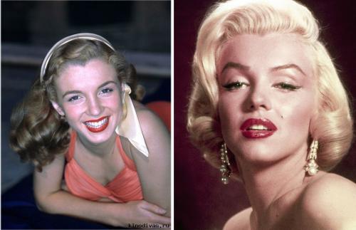 V образная линия роста волос у женщин прически. Что такое вдовий мыс и надо ли с ним бороться