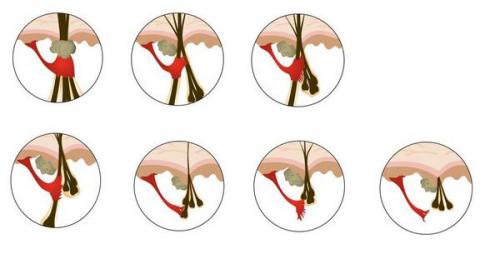 Линия роста волос у женщин. Симптомы выпадения волос 19 Линия роста волос у женщин. Симптомы выпадения волос 19