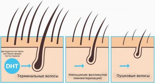 Линия роста волос у женщин. Симптомы выпадения волос 21 Линия роста волос у женщин. Симптомы выпадения волос 21