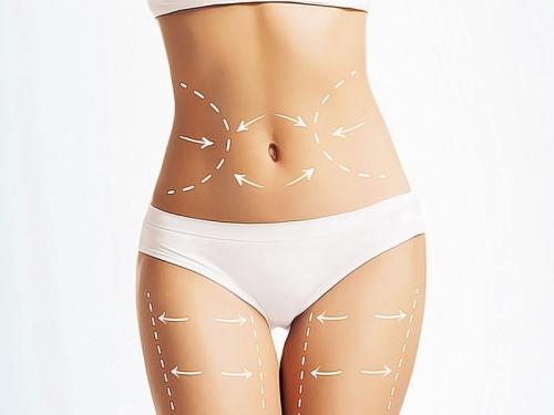 Что такое ультразвуковая липосакция? 04 Что такое ультразвуковая липосакция? 04