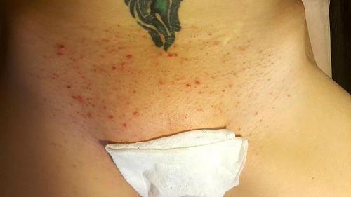 Зачем волосы в интимных местах у женщин. Волосы на лобке против их отсутствия 01