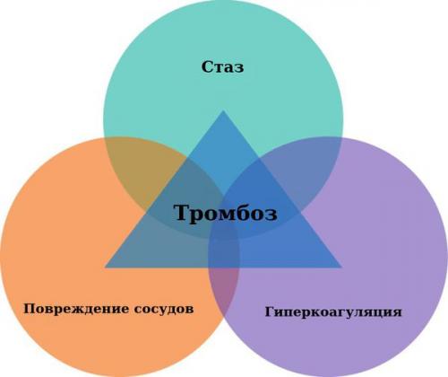 Тромбоз глубоких вен нижних конечностей. Определение болезни. Причины заболевания 01 Тромбоз глубоких вен нижних конечностей. Определение болезни. Причины заболевания 01