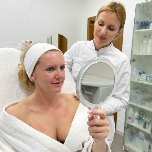 Какие методы лечения могут помочь устранить симптомы болезни на лице. Как убрать покраснения кожи на лице. Подход к лечению и контролю розацеа и покраснения на лице в нашей клинике Алента.