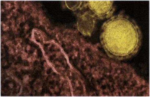 Три новых смертельных случая коронавируса в Белгороде за один день 04