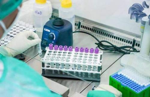 Кошки и COVID-19: факты и мифы о заражении кошек коронавирусом 01 Кошки и COVID-19: факты и мифы о заражении кошек коронавирусом 01