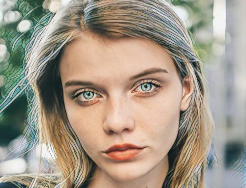 Кисетные морщины ботокс. Коррекция кисетных морщин над верхней губой