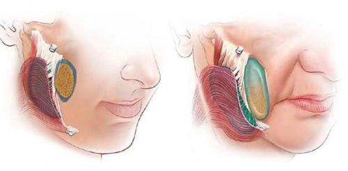 Как правильно проводить медовый массаж лица. Медовый массаж лица в домашних условиях 06 Как правильно проводить медовый массаж лица. Медовый массаж лица в домашних условиях 06