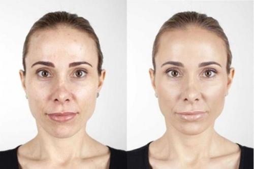 ТОП-6 способов придать лицу свежий вид. Как освежить лицо 09 ТОП-6 способов придать лицу свежий вид. Как освежить лицо 09