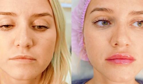 Одежда которая вышла из моды. Рейтинг видов одежды, которые вышли из моды 06 Одежда которая вышла из моды. Рейтинг видов одежды, которые вышли из моды 06