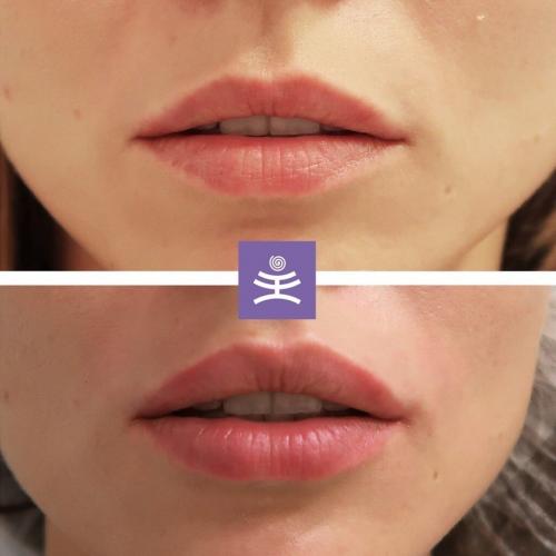 Одежда которая вышла из моды. Рейтинг видов одежды, которые вышли из моды 08 Одежда которая вышла из моды. Рейтинг видов одежды, которые вышли из моды 08