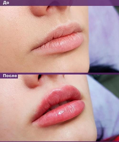 Одежда которая вышла из моды. Рейтинг видов одежды, которые вышли из моды 07 Одежда которая вышла из моды. Рейтинг видов одежды, которые вышли из моды 07