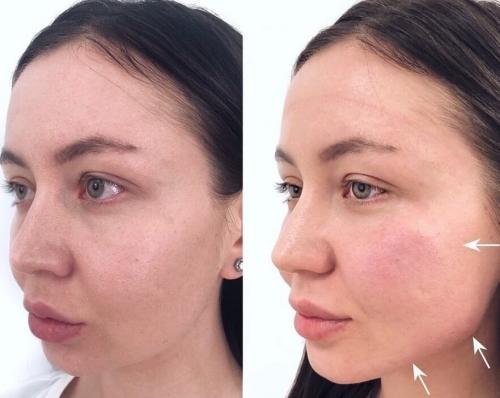 Одежда которая вышла из моды. Рейтинг видов одежды, которые вышли из моды 12 Одежда которая вышла из моды. Рейтинг видов одежды, которые вышли из моды 12