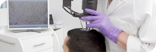 Могут ли волосы снова вырасти после выпадения при алопеции. Причины 02 Могут ли волосы снова вырасти после выпадения при алопеции. Причины 02