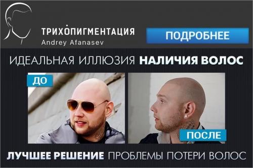 Могут ли волосы снова вырасти после выпадения при алопеции. Причины 01 Могут ли волосы снова вырасти после выпадения при алопеции. Причины 01