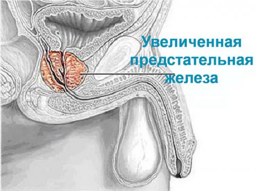 УЗИ малого таза у мужчин, как делают. Что входит в УЗИ органов малого таза у мужчин