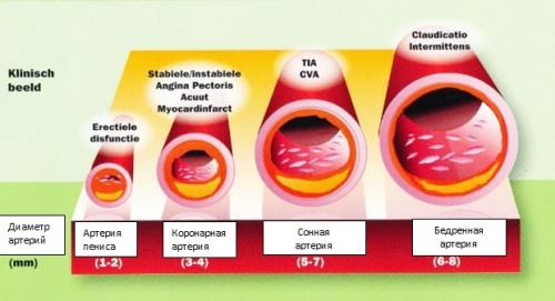 Причины и диагностика эректильной дисфункции. Определение болезни. Причины заболевания 07 Причины и диагностика эректильной дисфункции. Определение болезни. Причины заболевания 07