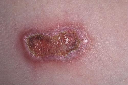 Болезни внутренних органов на лице. Оксана Жосан, гинеколог-онколог. Редактор А. Герасимова