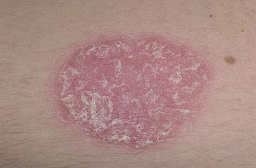 Болезни внутренних органов на лице. Оксана Жосан, гинеколог-онколог. Редактор А. Герасимова