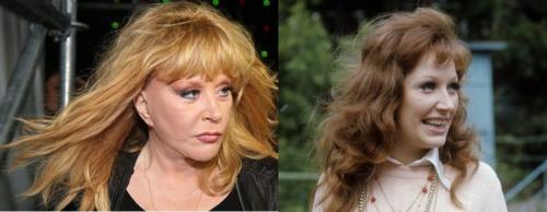 Какие пластические операции делала Алла Пугачева. Пластика лица, которую делала Алла Пугачева