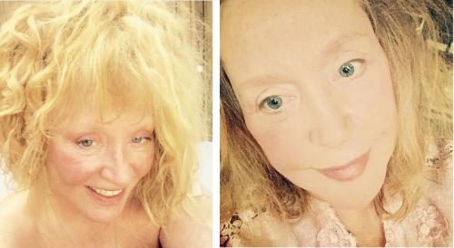 Какие пластические операции делала Алла Пугачева. Пластика лица, которую делала Алла Пугачева