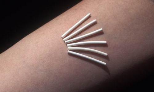 Какие методы контрацепции являются наиболее эффективными и безопасными для женского здоровья. Гормональные инъекции