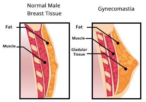 Почему молодые мужчины теряют волосы: основные причины 03