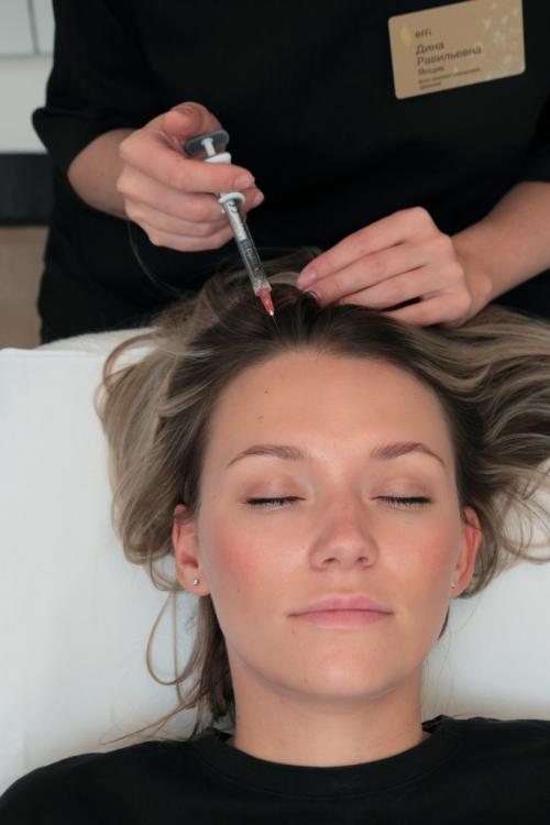 Почему выпадают волосы у девушек и молодых женщин: основные причины 01 Почему выпадают волосы у девушек и молодых женщин: основные причины 01