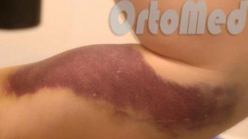 Первая помощь при ушибах, порезах и ссадинах 02 Первая помощь при ушибах, порезах и ссадинах 02