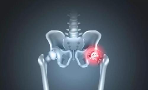 Болит икра правой ноги при ходьбе. Причины болей в правой ноге