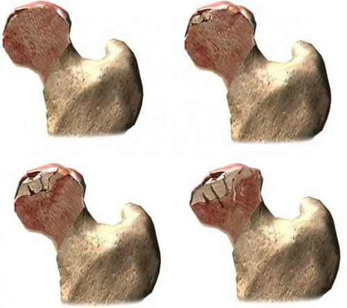 Болит икра правой ноги при ходьбе. Причины болей в правой ноге