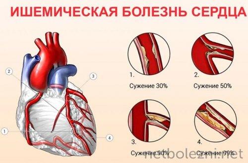 Почему люди умирают не от COVID-19: основные причины 09