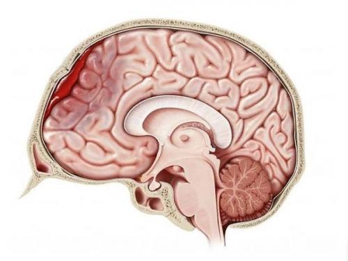 Какое воздействие на мозг могут оказать последствия ушиба головы. После удара головой или после падения