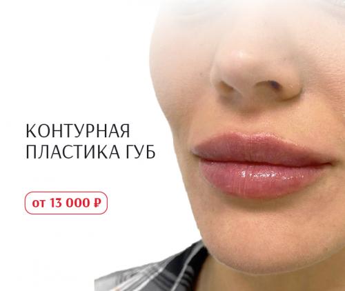 Какие продукты для ухода за кожей могут помочь избавиться от черных точек на лице